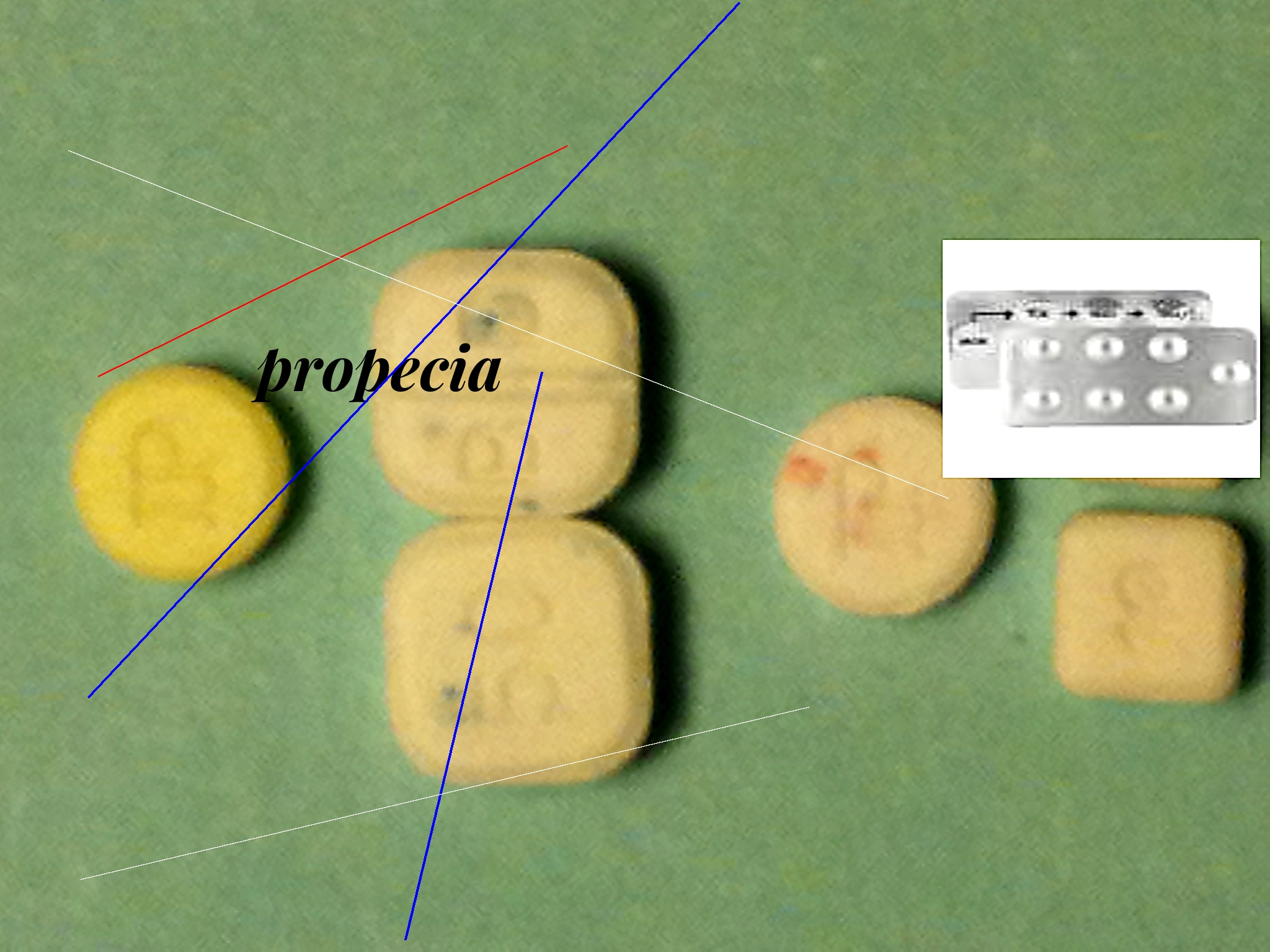 Acheter propecia 1mg